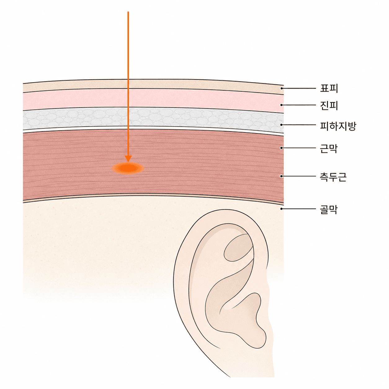 관자놀이는 피부와 뼈 사이가 유난히 얇고, 그 사이를 씹는 근육이 채우고 있어요.