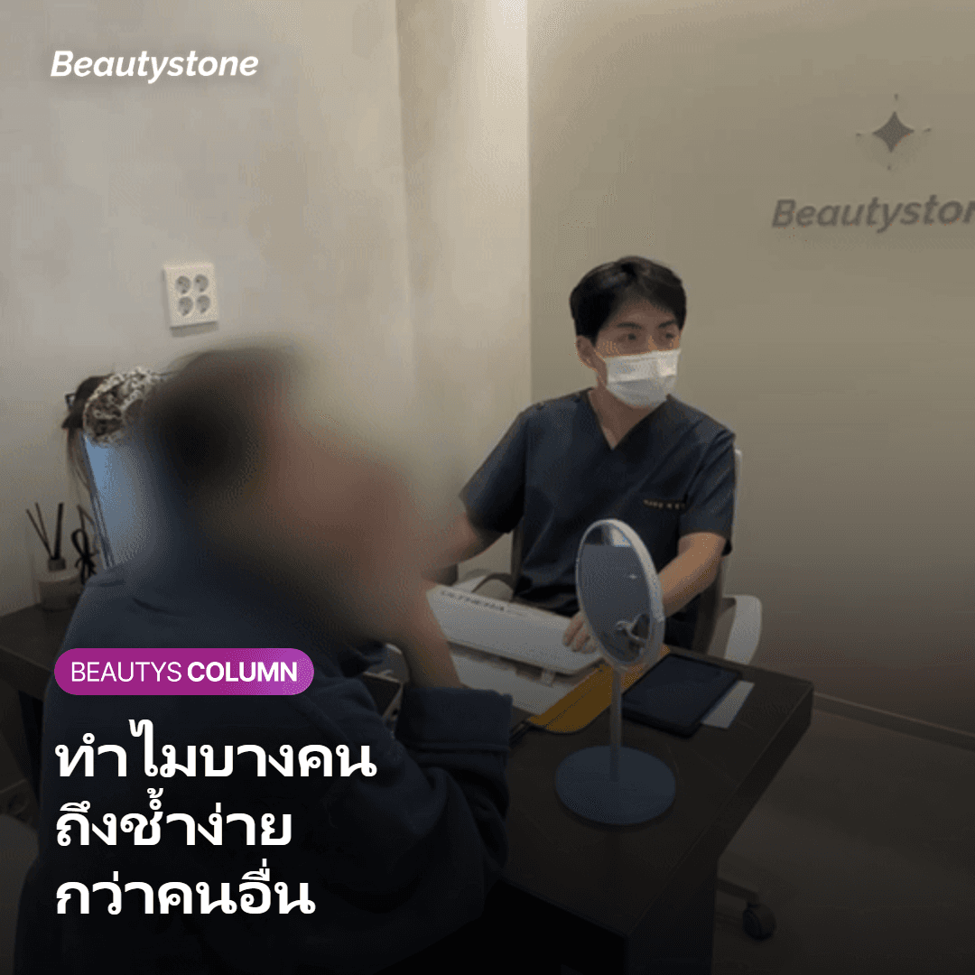 ภาพแสดงสาเหตุที่บางคนช้ำง่ายกว่าคนอื่น
