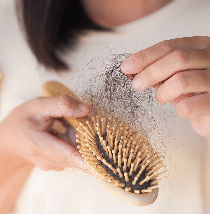 hair loss from Hair Loss and Alopecia Areata