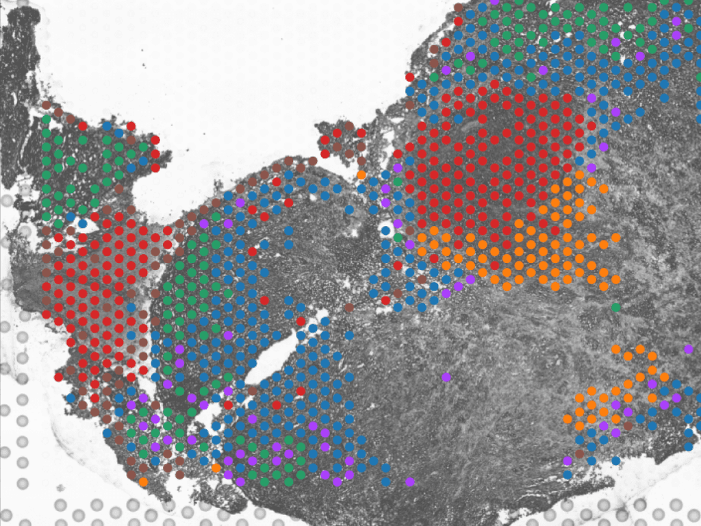 Split-screen image of spatial transcriptomics, the visualizaition and quantification of gene expression in tissue sections while maintain the context of tissue architecture. To perform sequence alignment, a reference genome is needed. One technology for spatial transcriptomics is 10x Genomics Visium which uses a slide  array of spots, each containing barcoded oligonucleotides, to capture mRNA from tissue sections placed on the slide. The mRNA then undergoes high-throughput RNA sequencing. The raw results from Visium experiments include a microscopy image of the tissue slice on the Visium slide and sequencing reads in FASTQ format. In order to use this data to reveal insights into cellular microenvironments, cellular heterogeneity, and spatial relationships within tissue, the data require processing, including the typical steps taken for processing RNA sequencing reads, as well as tissue detection and determination of which barcode spots overlap with the tissue.