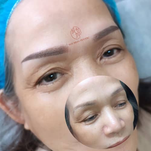 居銮眉毛纹绣，Kluang Eyebrow Embroidery，Skin Treatment