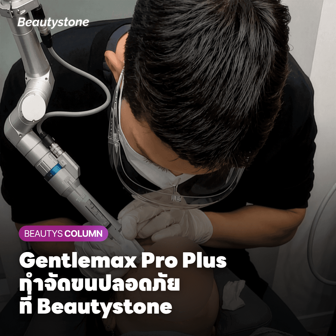 Gentlemax Pro Plus กับการกำจัดขนอย่างปลอดภัย