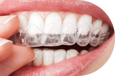 正畸协会认证牙医，AiCare Orthodontics，位于加州橙县，芳泉谷，尔湾，为全年龄段提供正畸服务