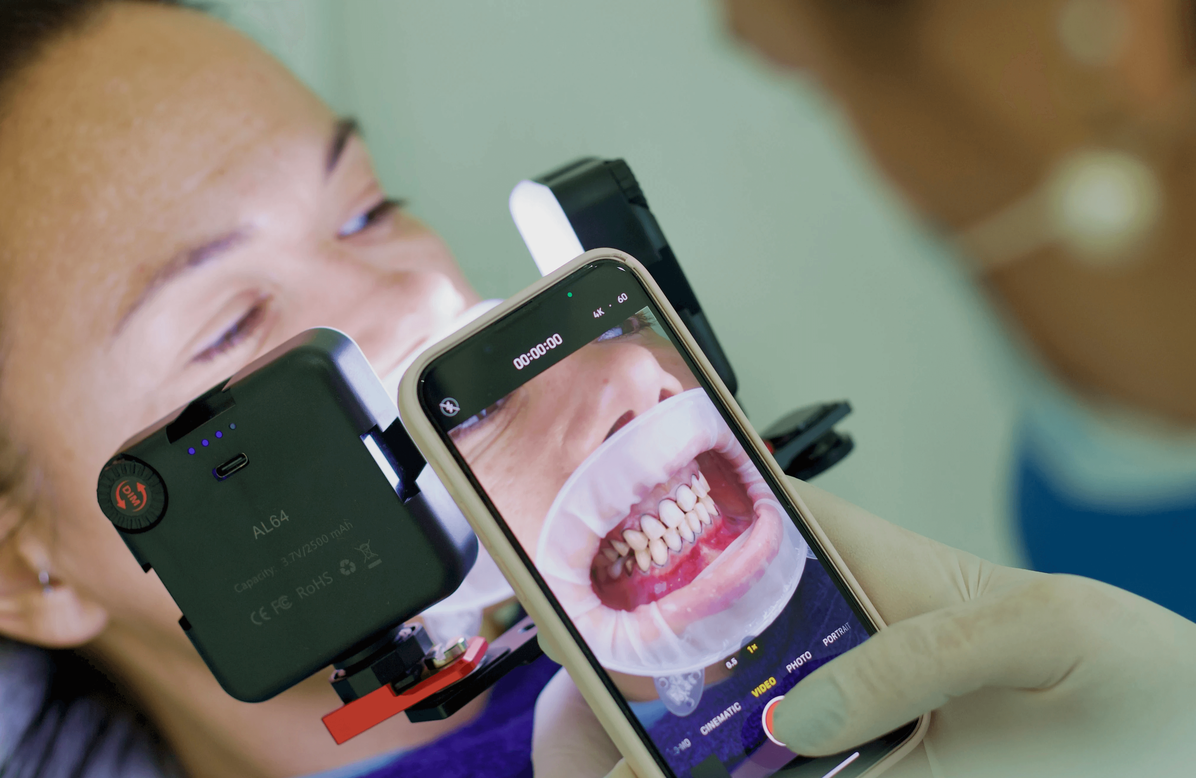 A patient getting her teeth cleaned and ready for clear aligners by Invisalign Center
