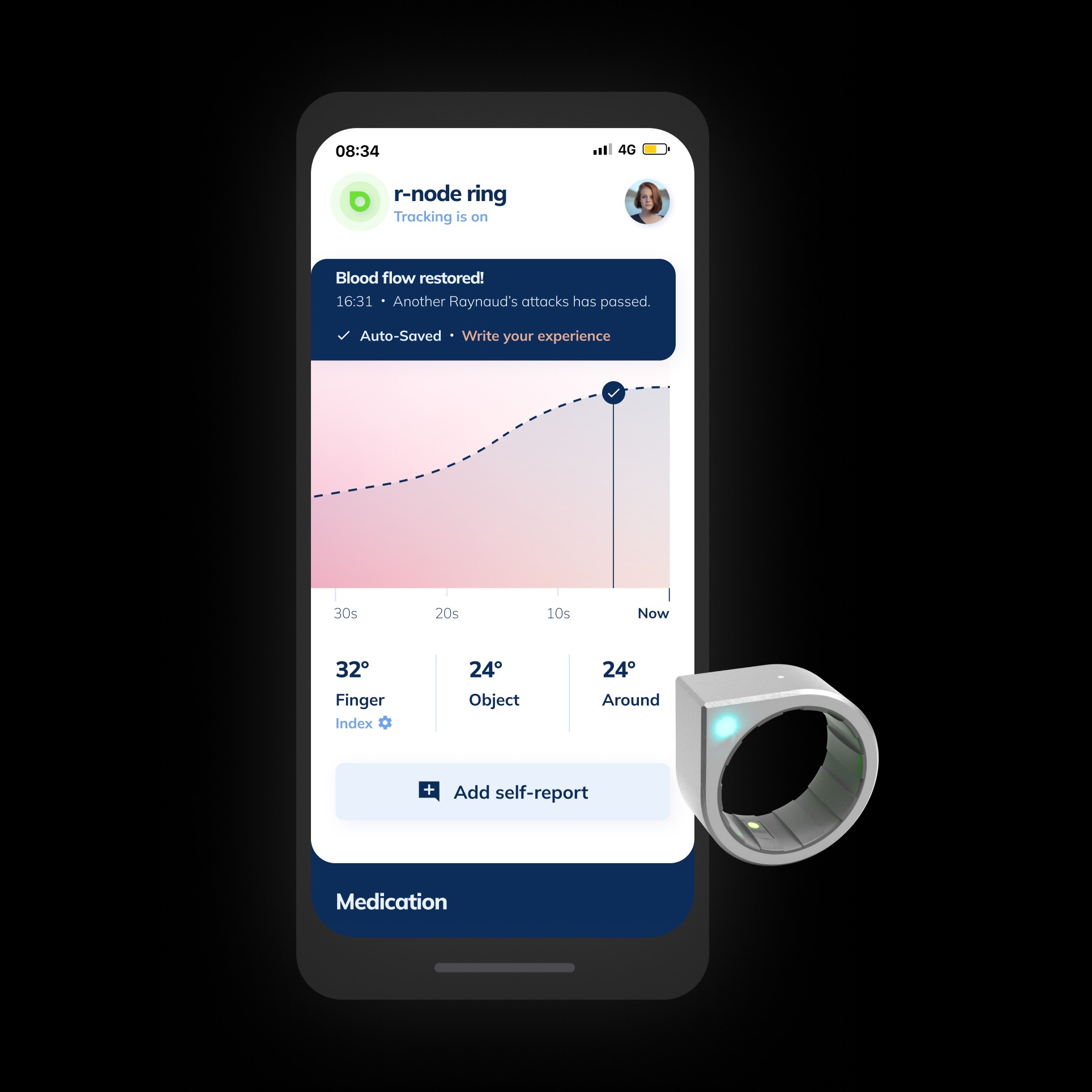 Raynauds monitoring app and ring