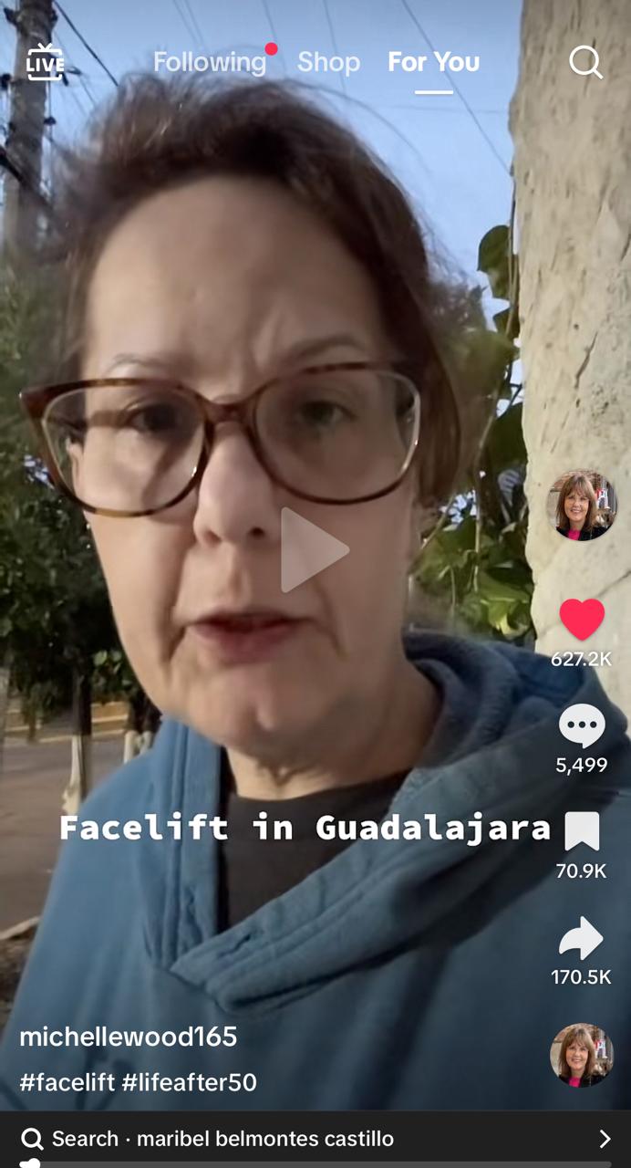 facelift in guadalajara