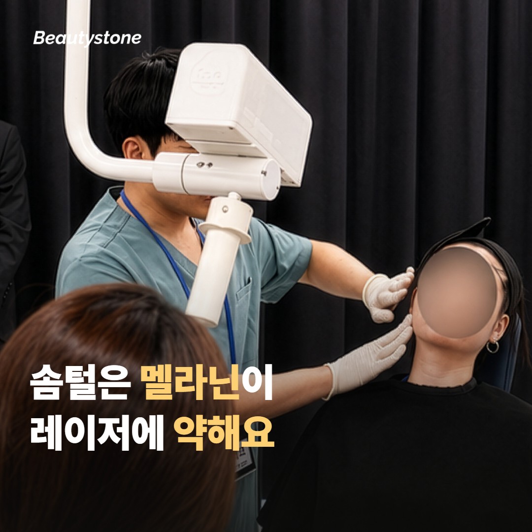 얼굴 솜털과 화장 들뜸, 무엇이 먼저 신경 쓰이세요