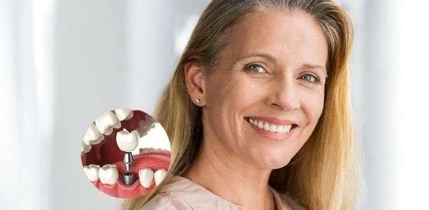 Zirconia dental crown placement on implant diagram at COSDENT Smile Design
