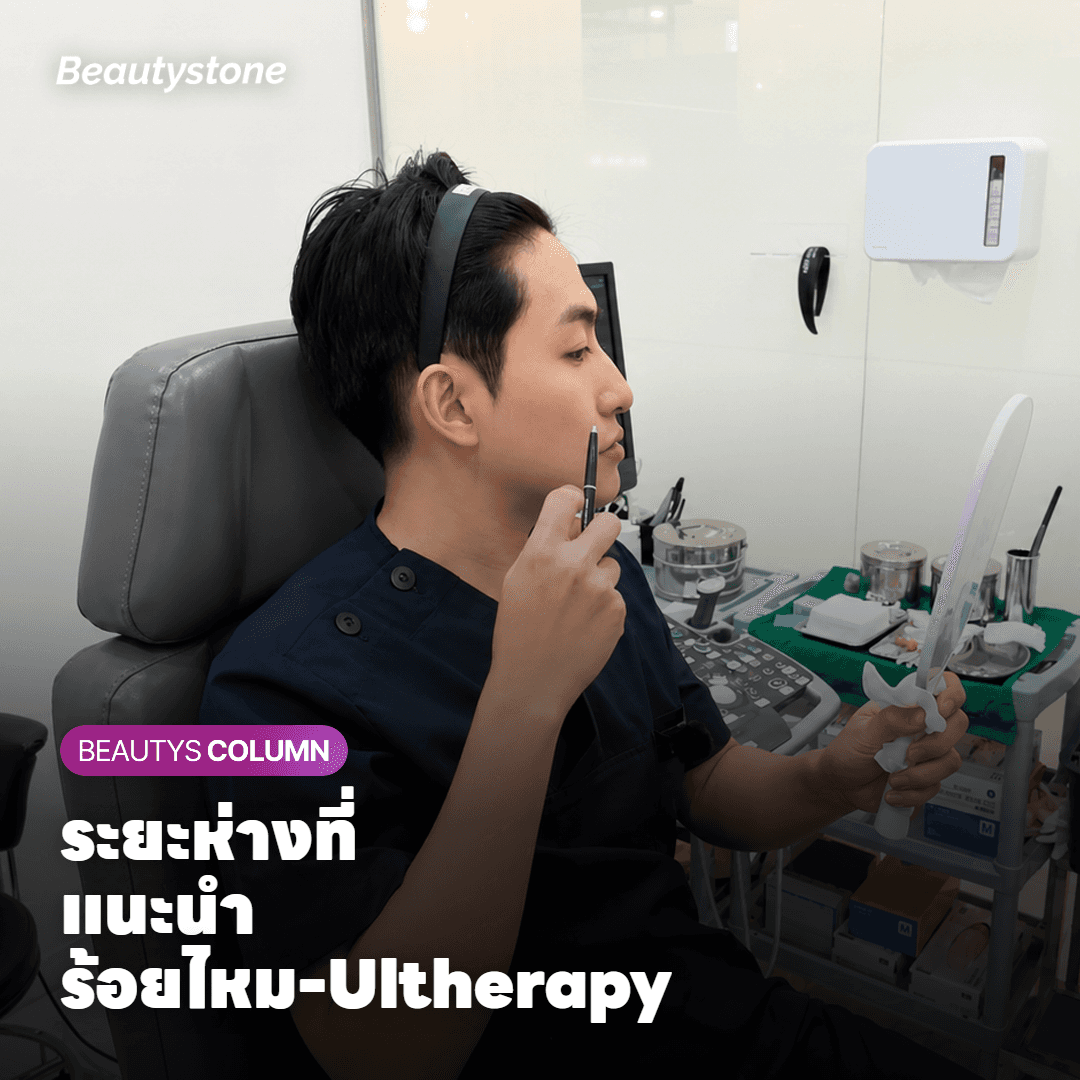 ระยะห่างที่แนะนำระหว่างการร้อยไหมและ Ultherapy Prime