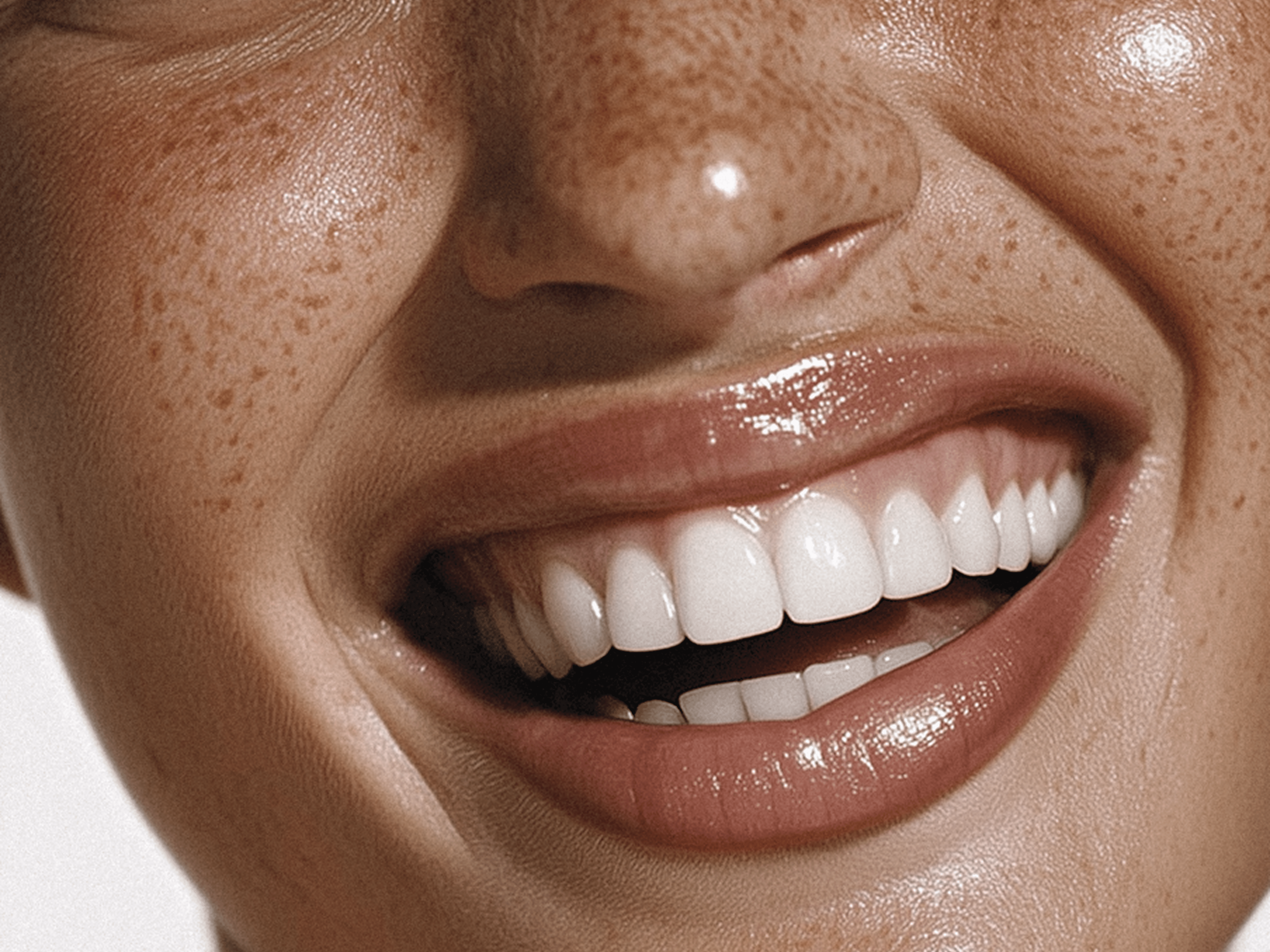 Smiling mouth with white teeth and freckles.