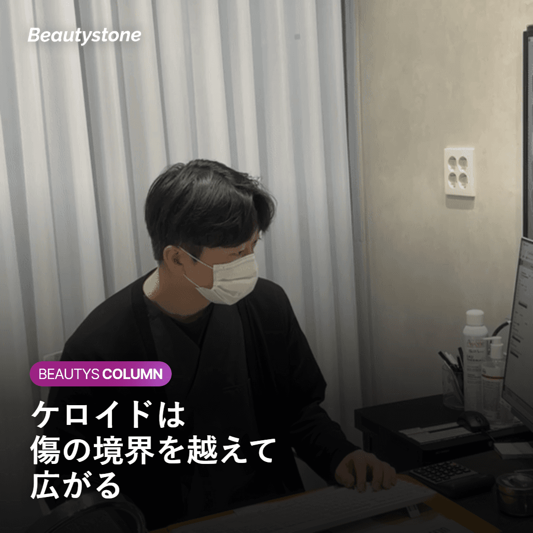 ケロイドが傷の境界を越えて広がることを示す図