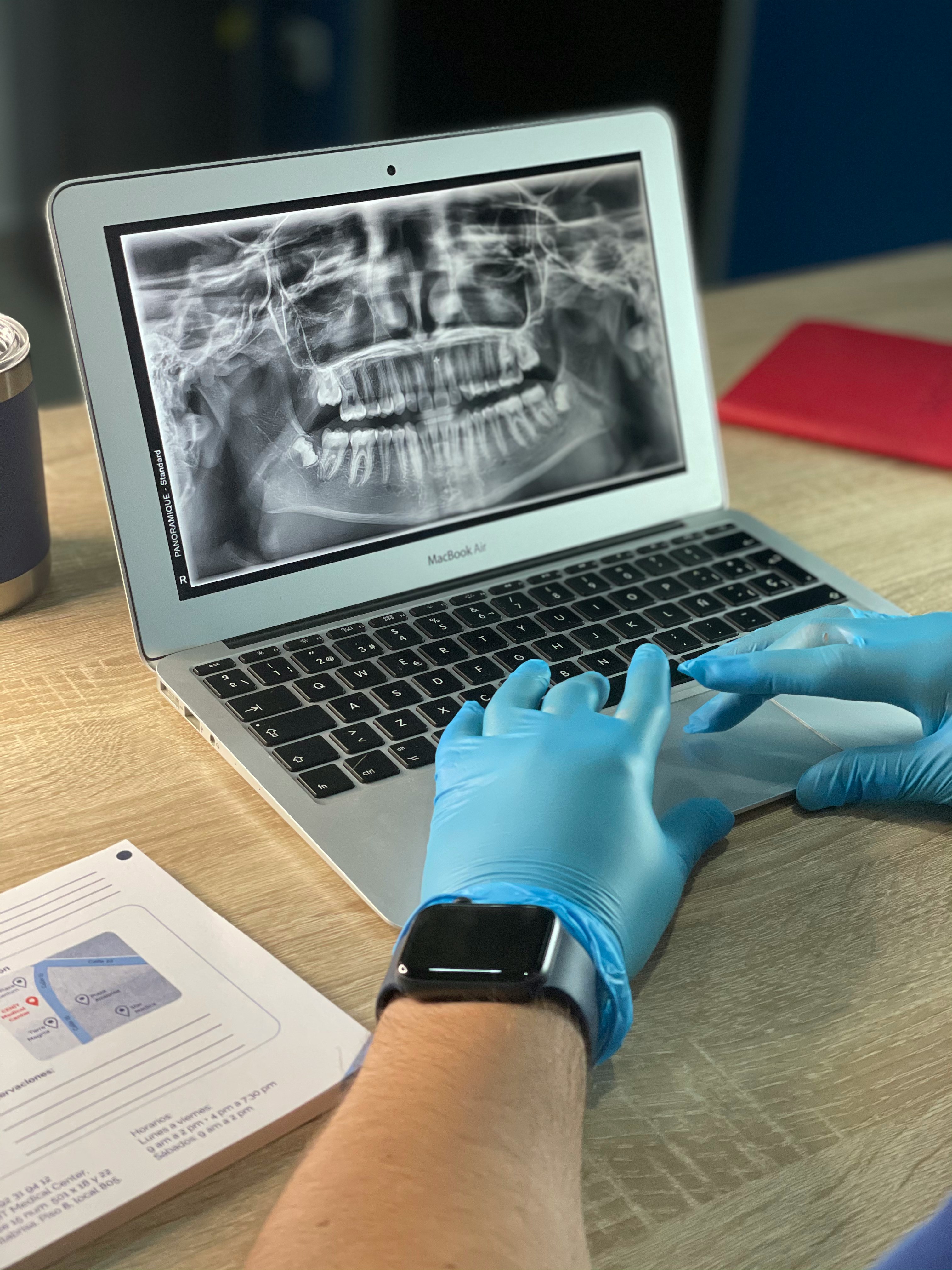 Dental Filling