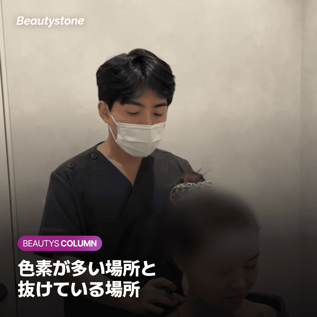 ホクロ・タトゥー・傷跡・ケロイドの色素の深さと密度を比べた図