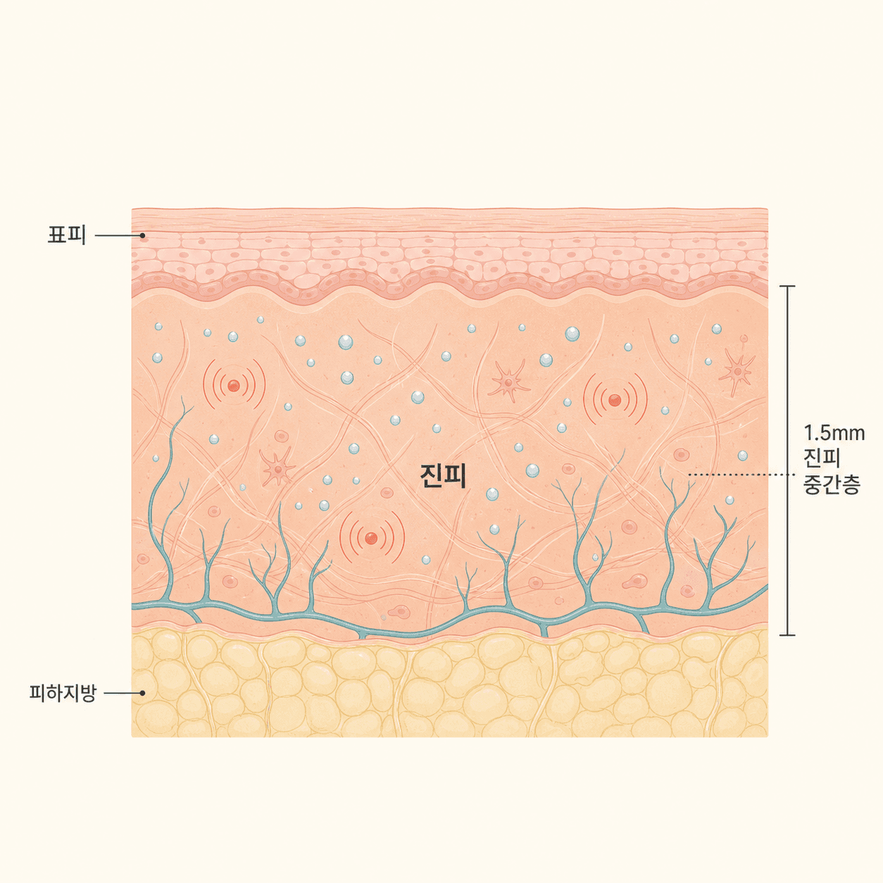 열 자극이 닿는 진피와 수분이 채워지는 상부 진피층