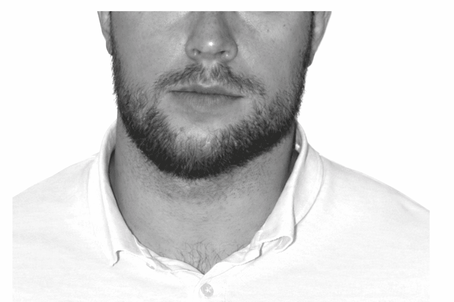 Asymmetrie, UDL