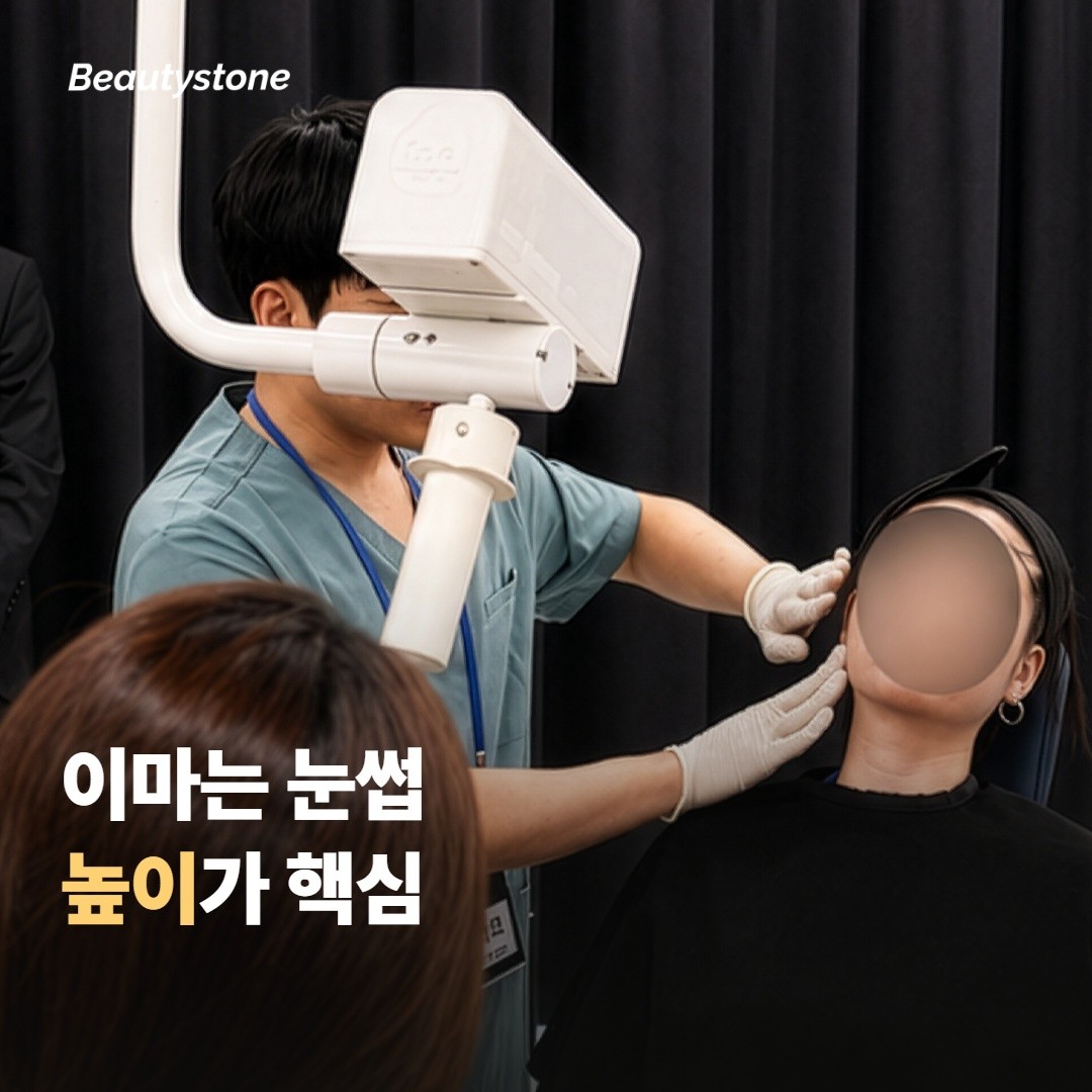 이마 주름 — 눈썹 높이를 함께 봐야 한다