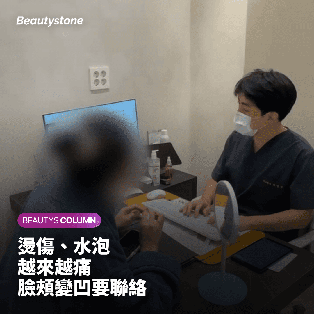 哪些副作用不要等：燙傷、水泡、臉頰變凹