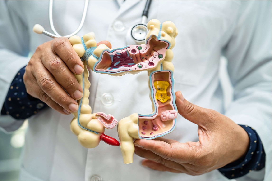 Gut Microbiome 101: What It Is, Why It Matters, and How to Support It