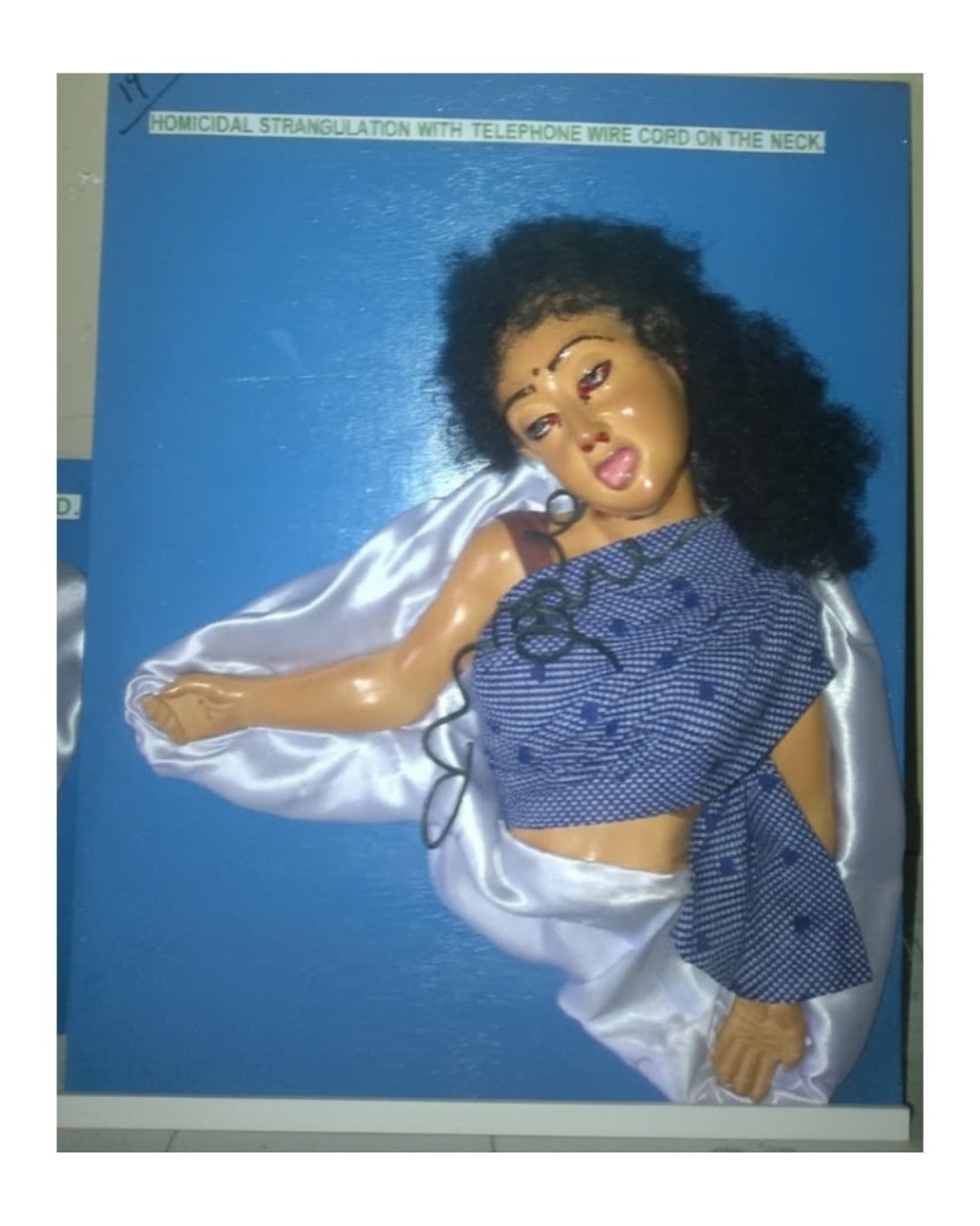 Homicidal Strangulation with Telephone Wire Cord