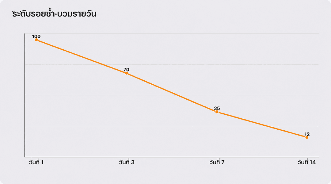 ระดับอาการช้ำและบวมตามวันฟื้นตัว