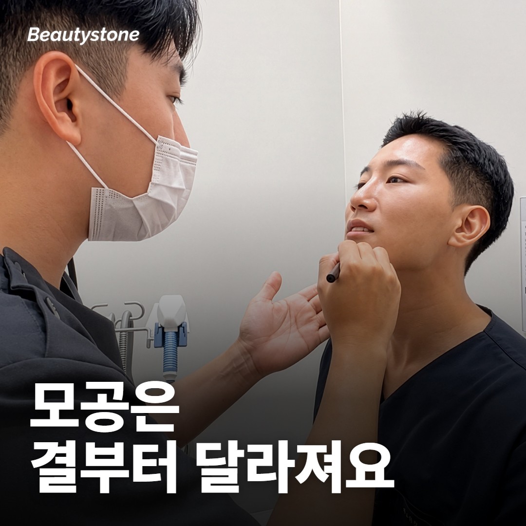 모공에는 얼마나 달라져요?