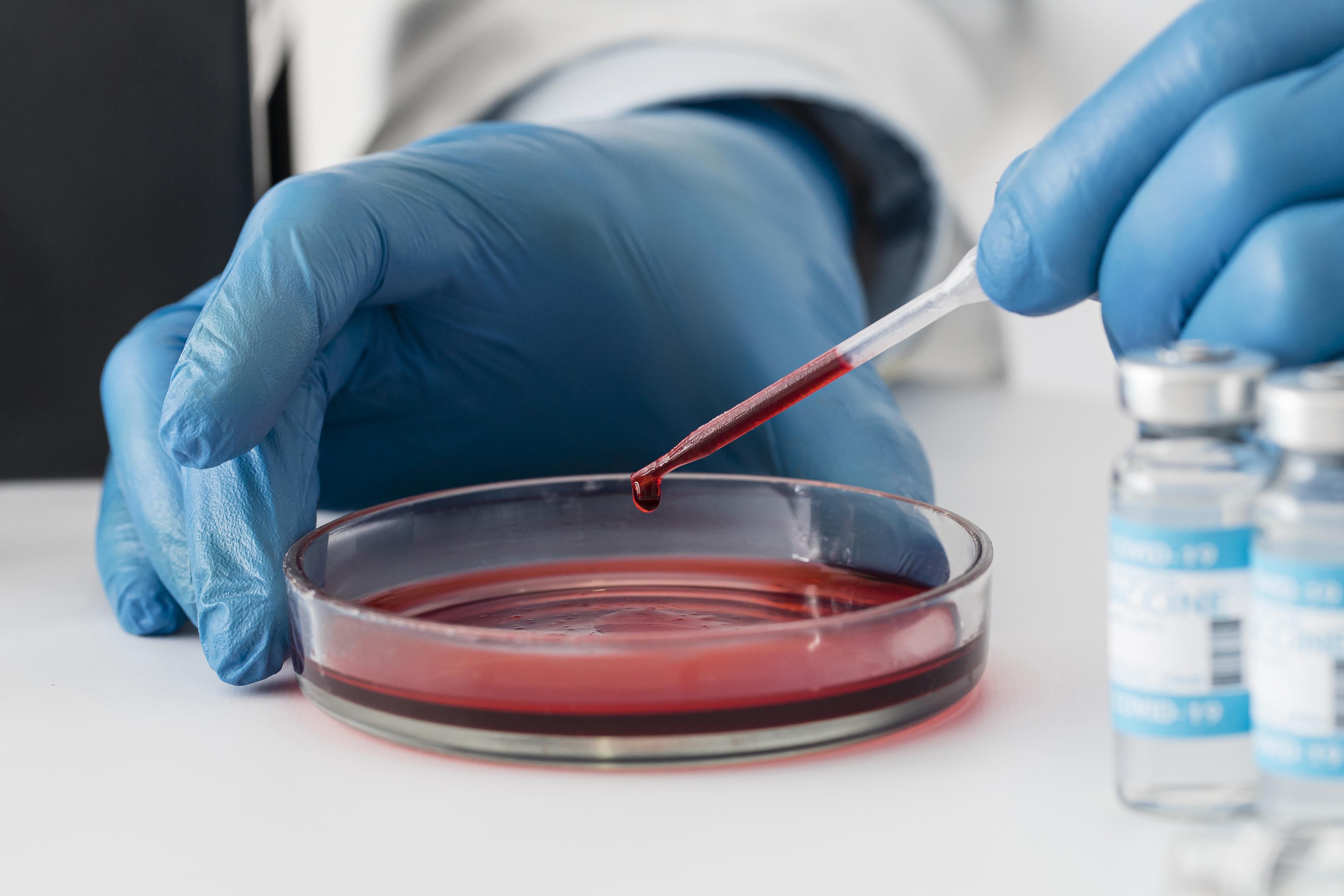 Blood Cancer Treatment Cost