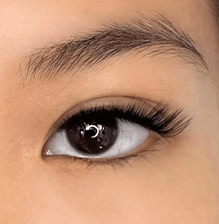 Before and after