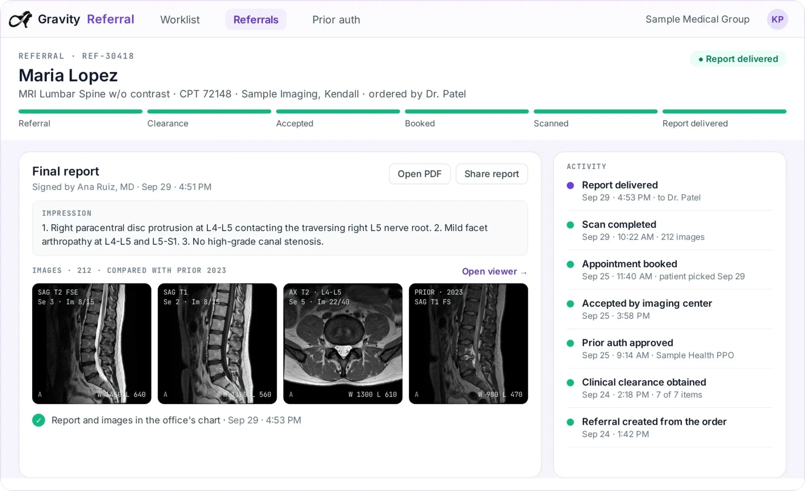 A referral in Gravity Referral: an MRI of the lumbar spine with every stage complete, the signed final report and its impression, four images compared with a prior study, and the activity from referral to report delivered