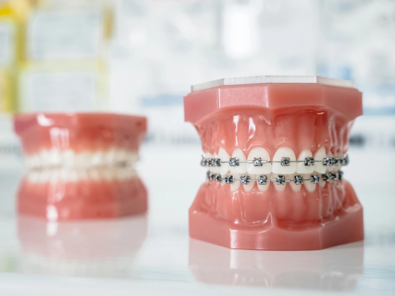 2 tooth models, one with braces, the other blurred without braces