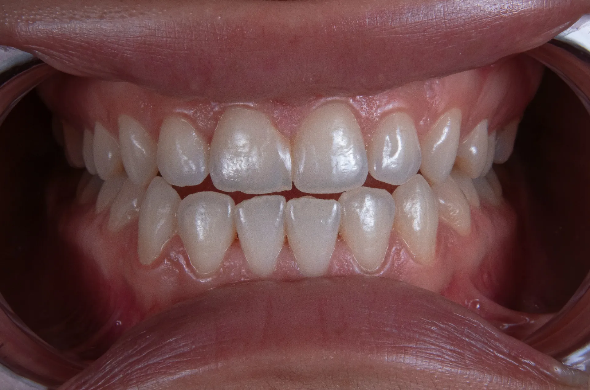 Image of a bad smile