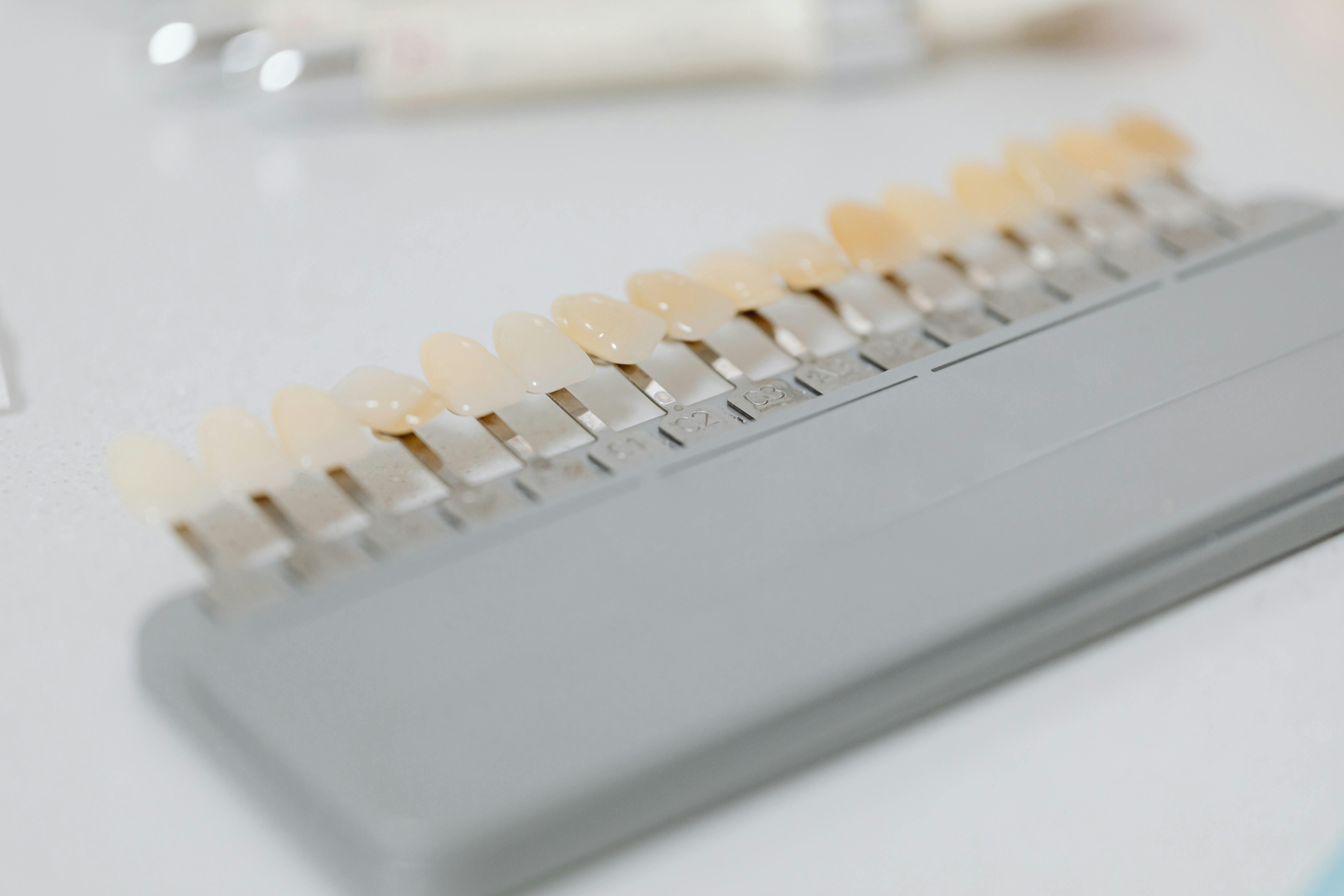 dental veneers