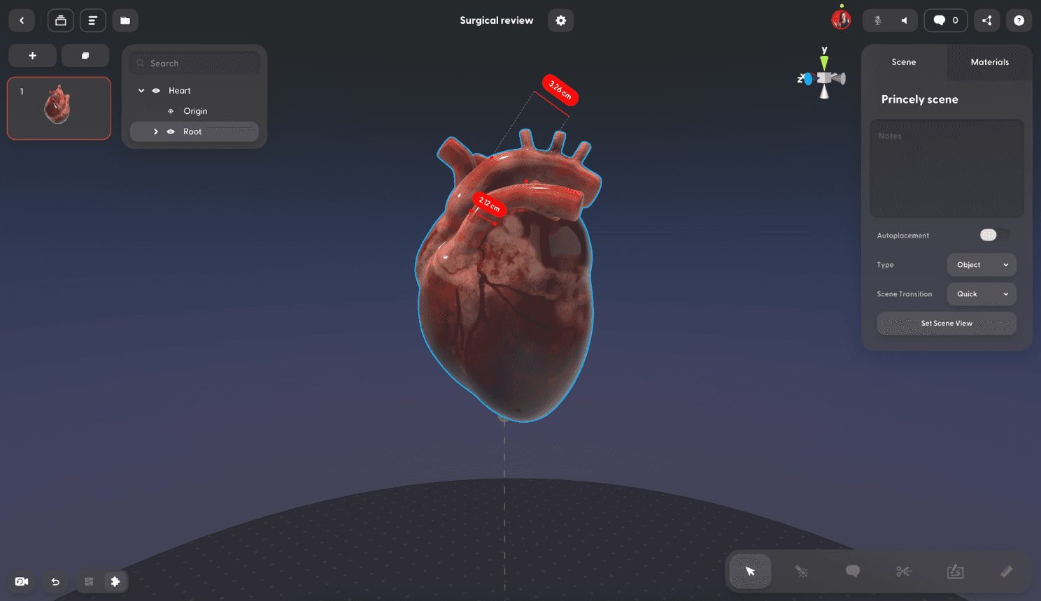 A 3D model of a heart, displayed within the user interface of Campfire