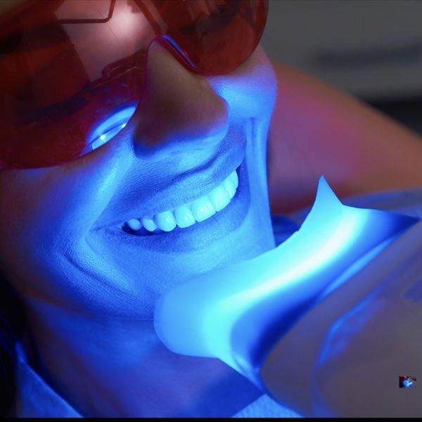 Teeth Checkup