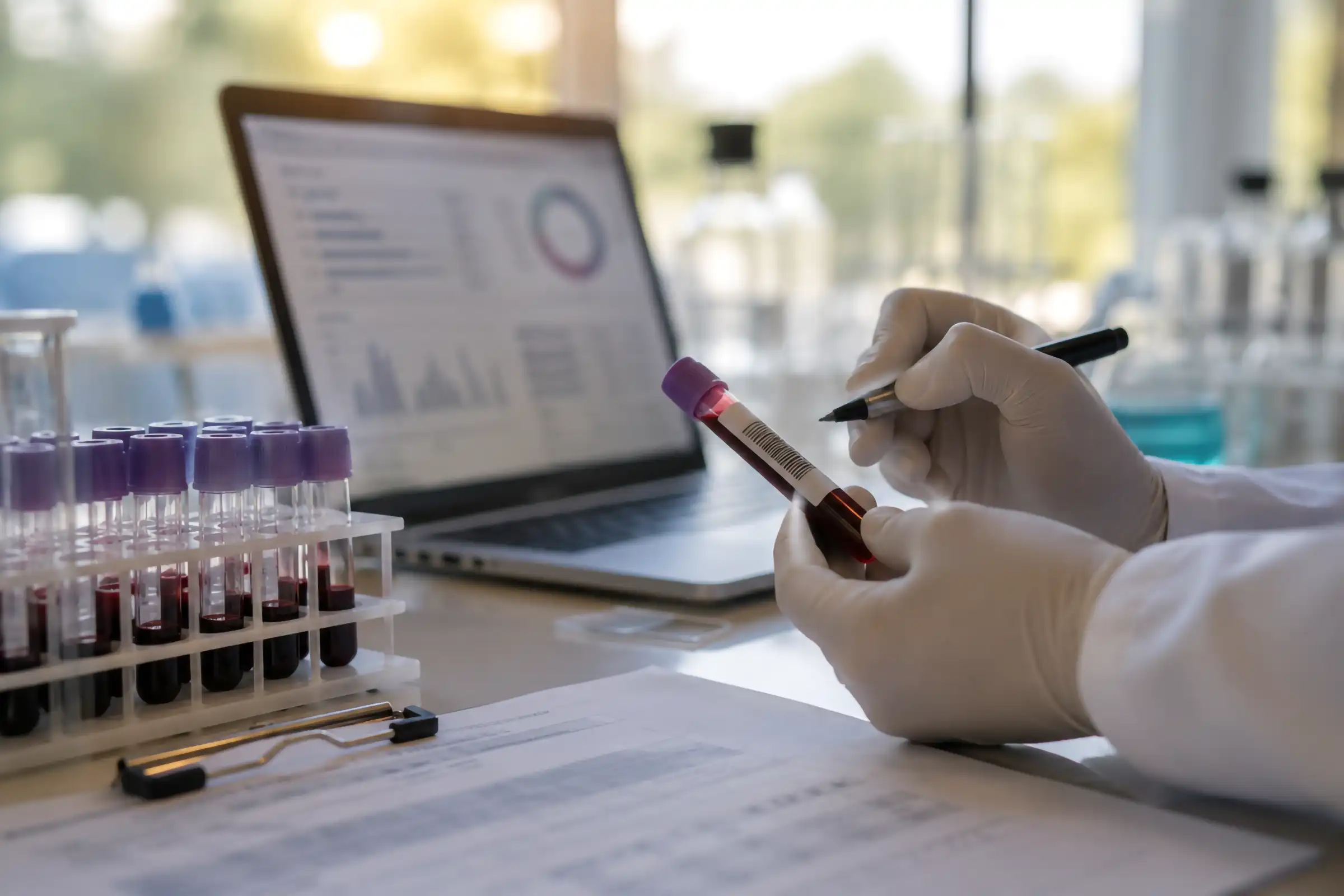Blood sample review and biomarker analysis used to guide precision medicine and preventive care.