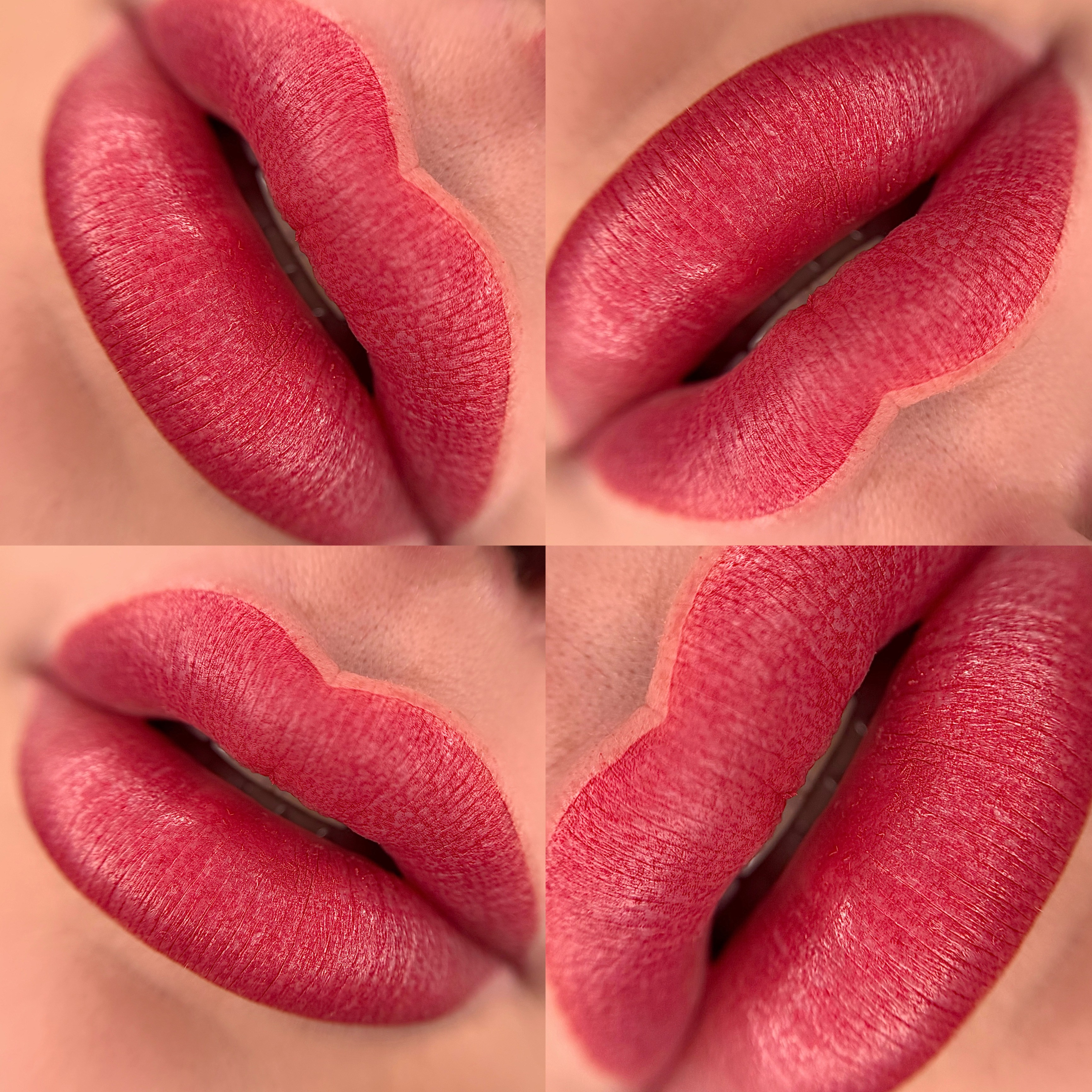 Macro shot of lips after a lip blush
