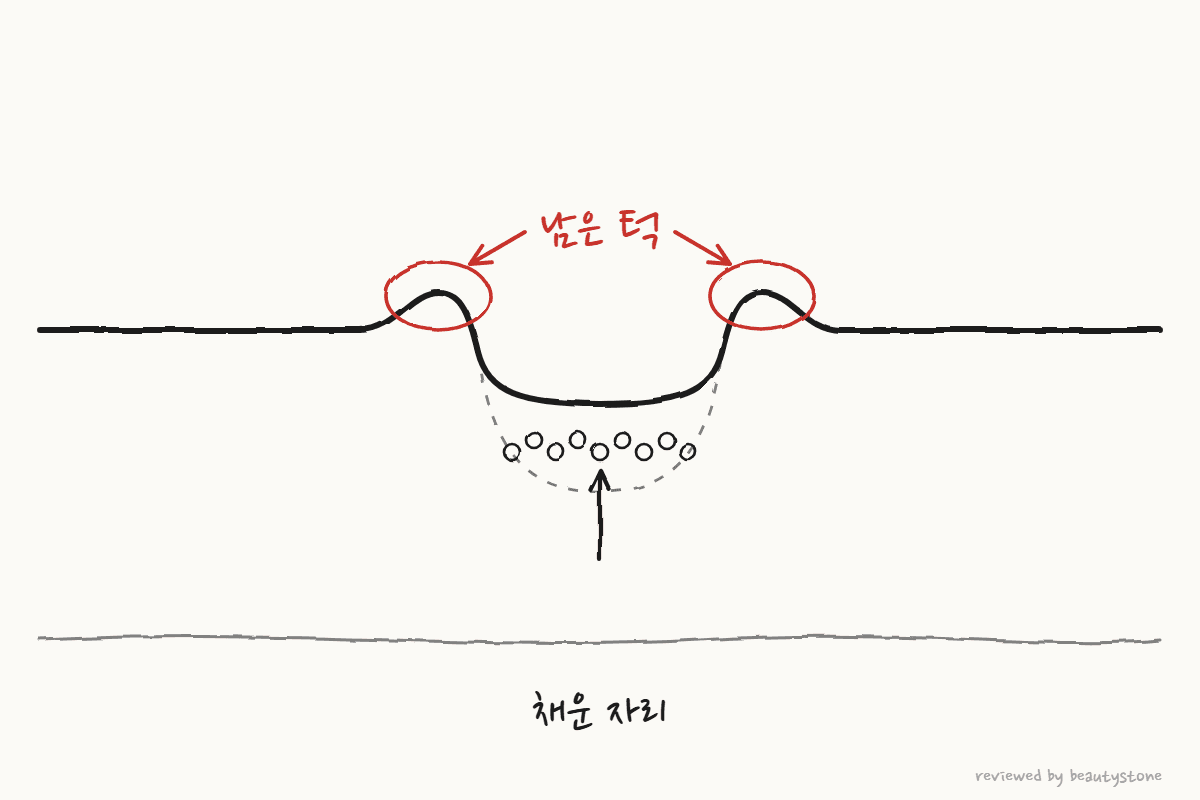 바닥은 채웠지만 가장자리에 턱이 남은 단면을 펜으로 그린 그림