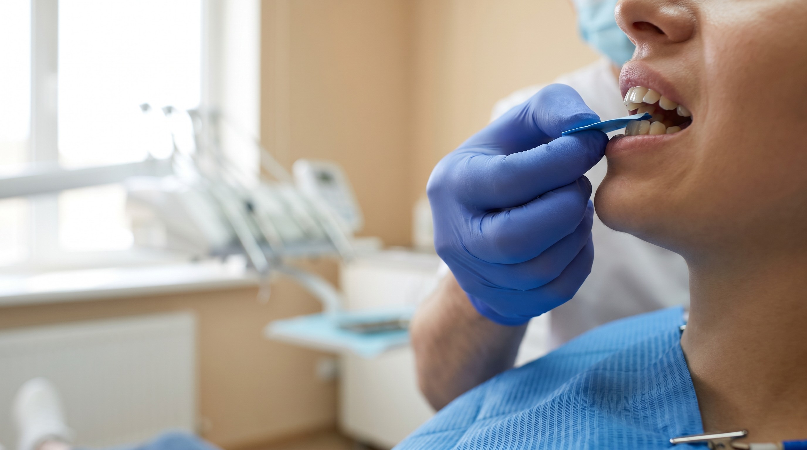 Dentist using blue articulating paper to check a patient's bite on a back tooth