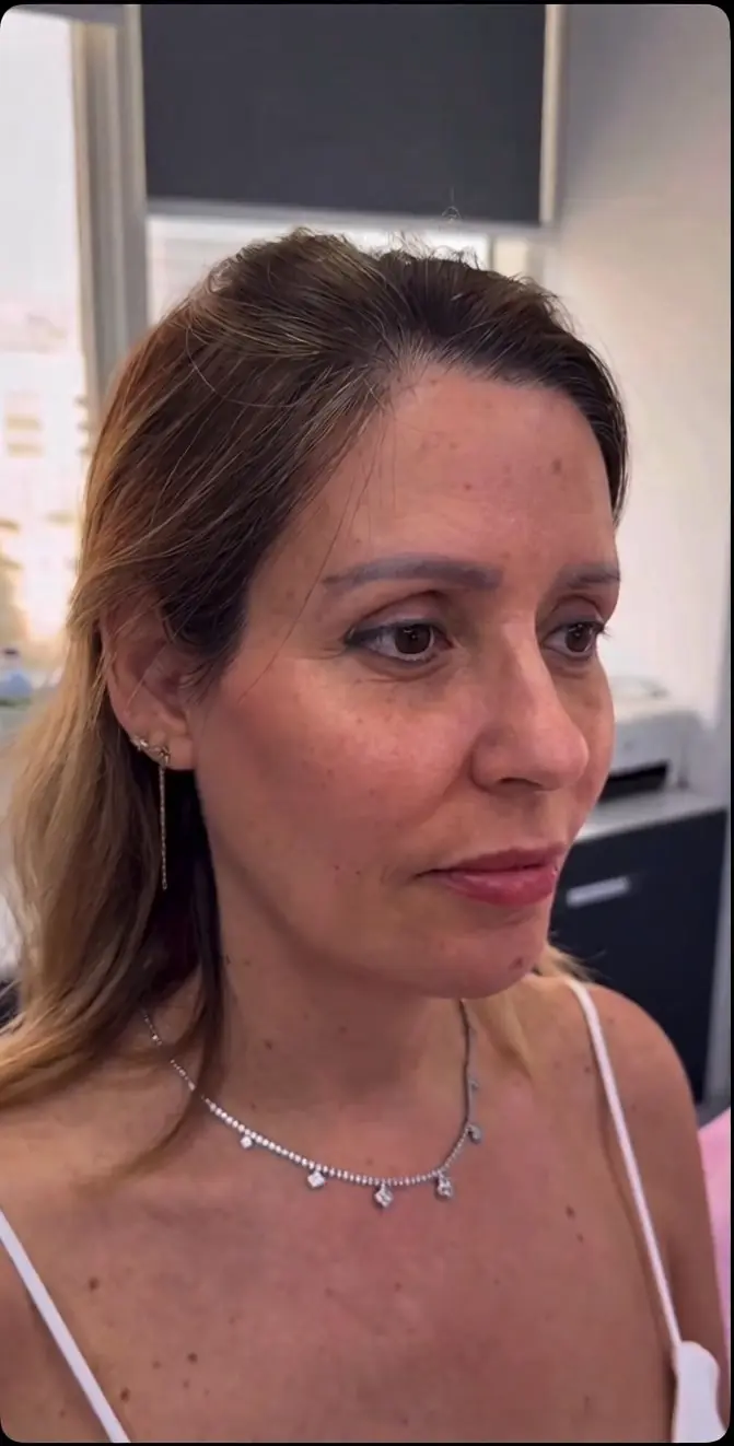 Caso 1 después del tratamiento
