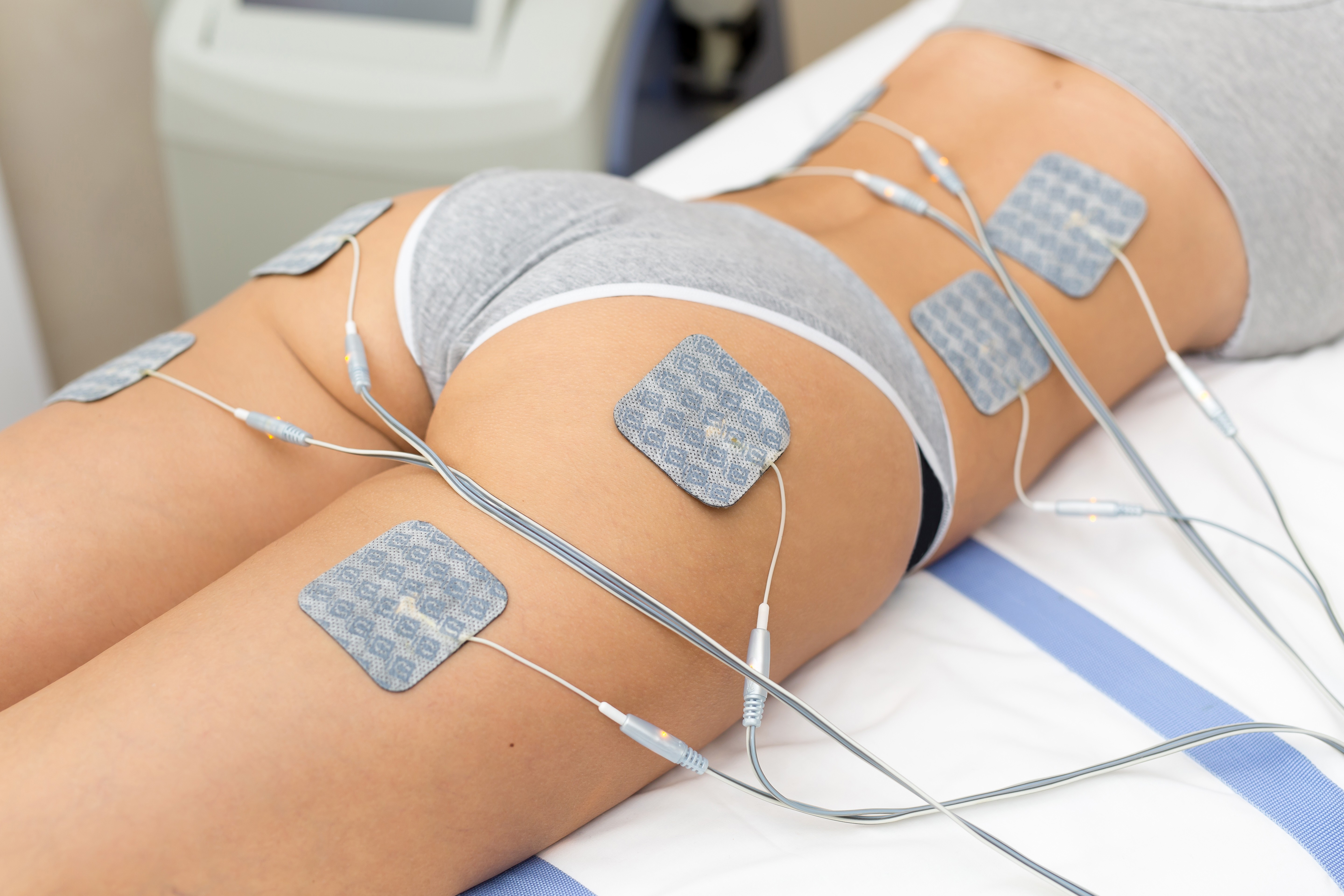 Sesión de electroestimulación corporal en San Fernando. Una persona recostada boca abajo tiene parches de electrodos grises adheridos en glúteos, caderas y espalda para tonificación muscular y reafirmación.
