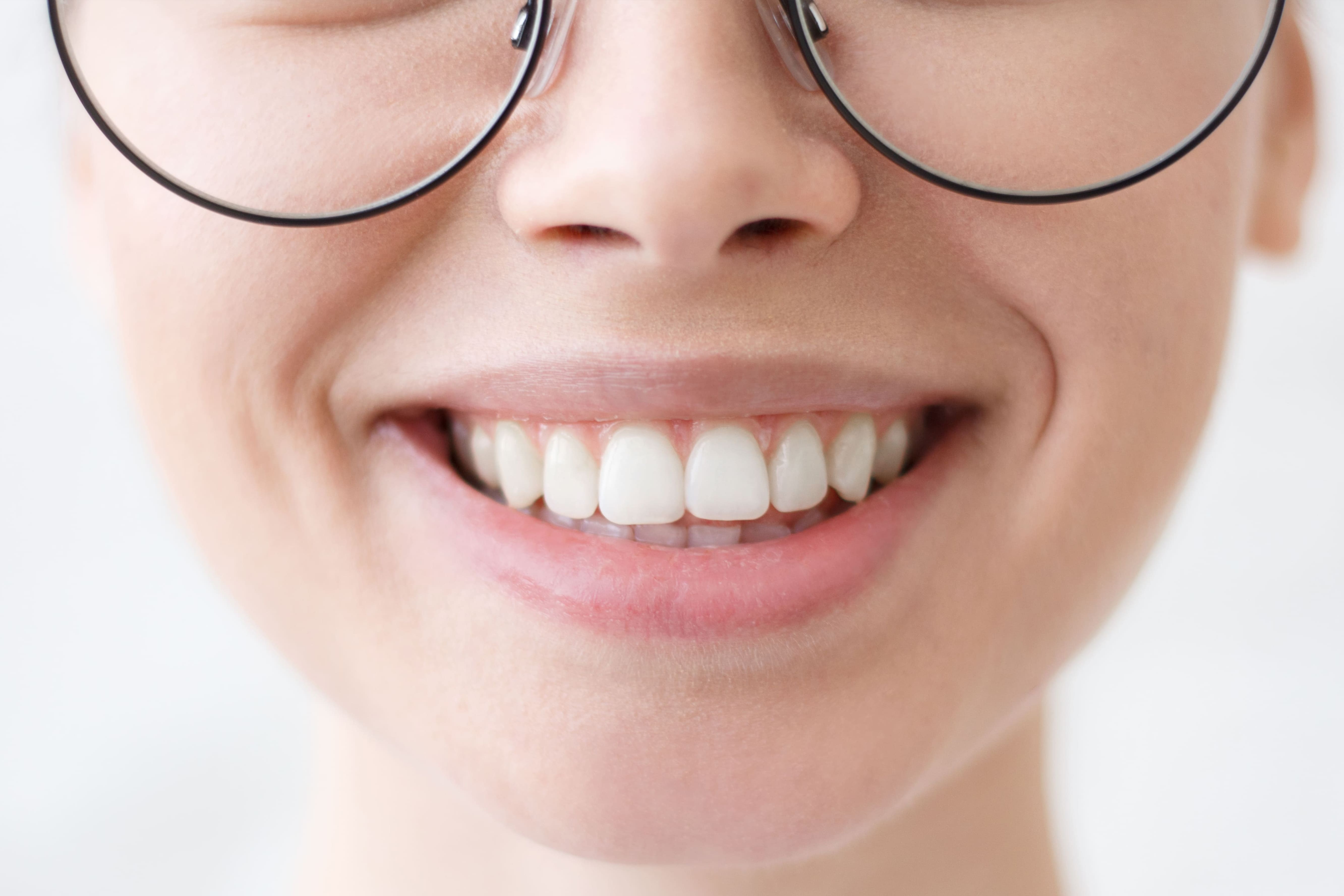 Sbiancamento Dentale Ferrara