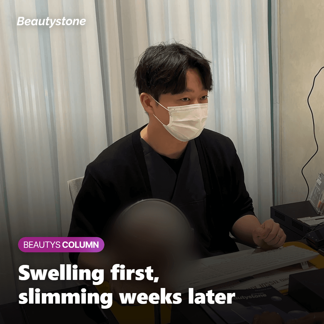 Illustration of the recovery timeline after a double-chin fat-dissolving session, from swelling to visible slimming