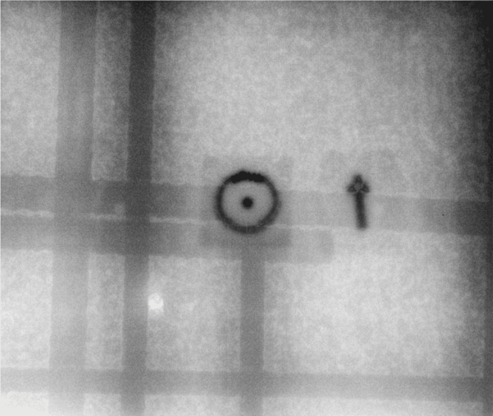 Clean Digital Concrete X-Ray Image in Radii-x Software