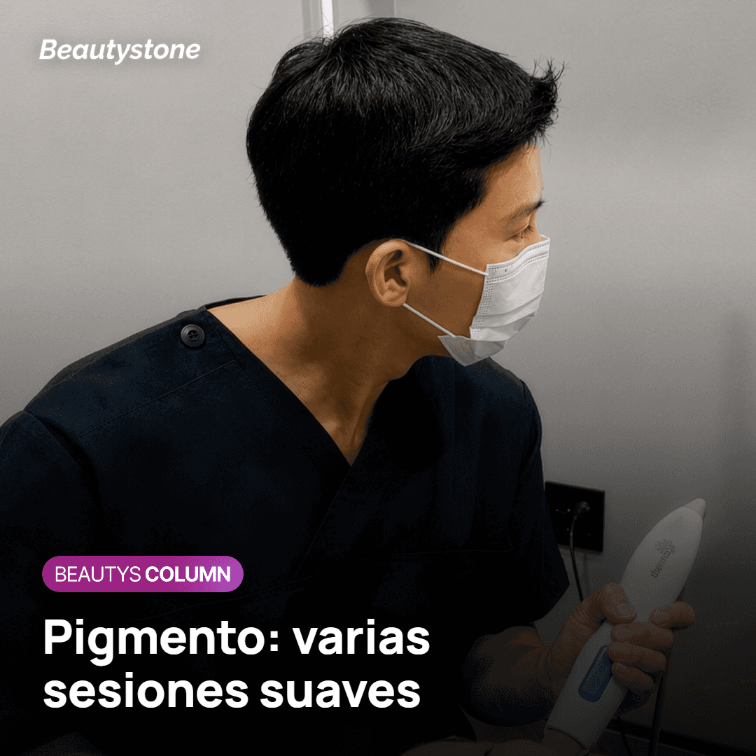 Ojeras por pigmento tratadas con láser en varias sesiones