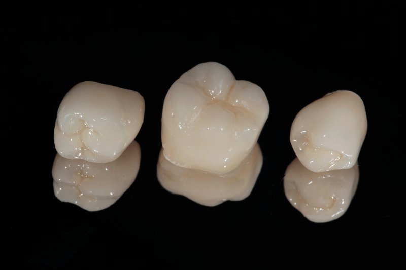 same-day dental crowns