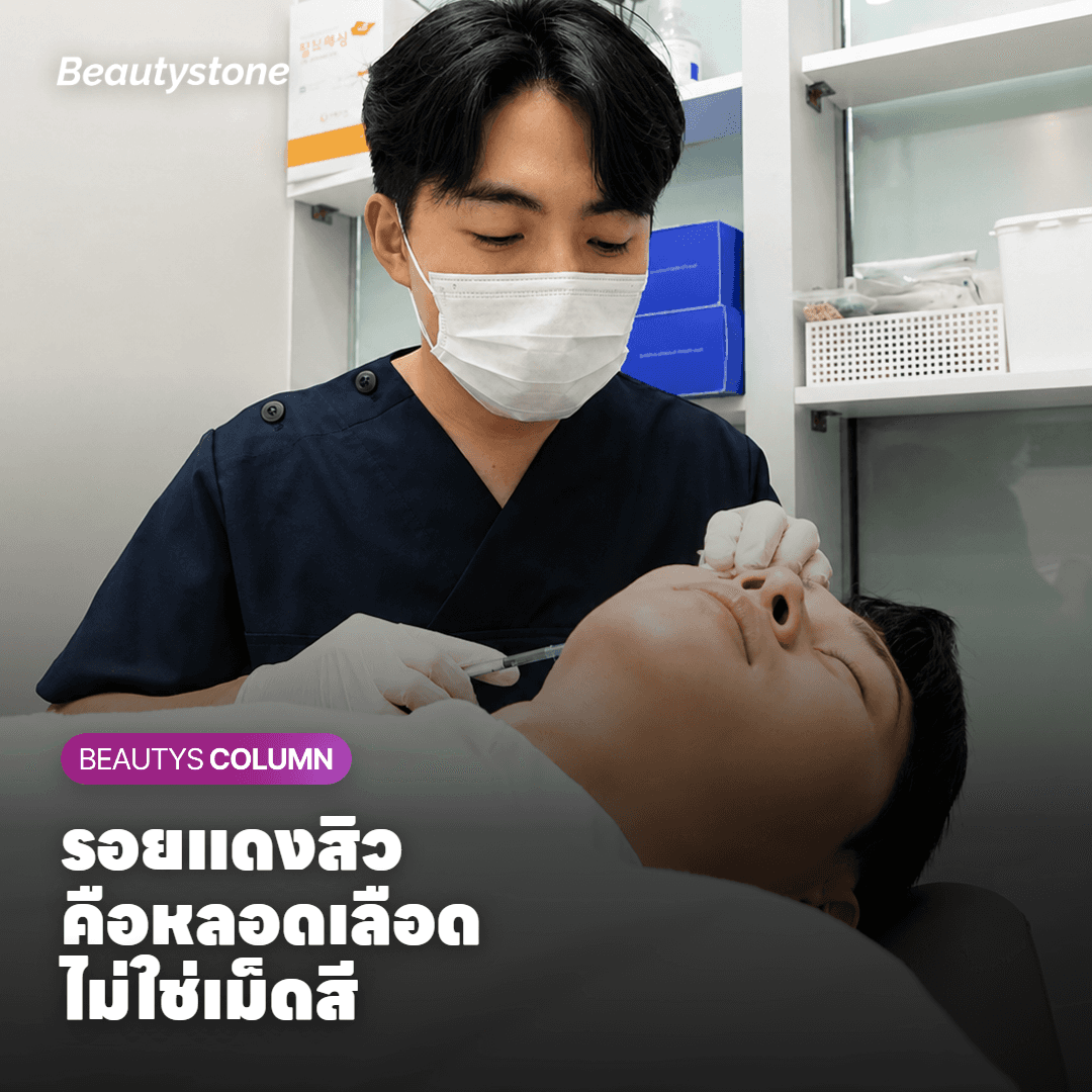 รอยแดงจากสิวเกิดจากอะไร ทำไมยาทาฟื้นฟูผิวไม่ได้ลบรอยโดยตรง?