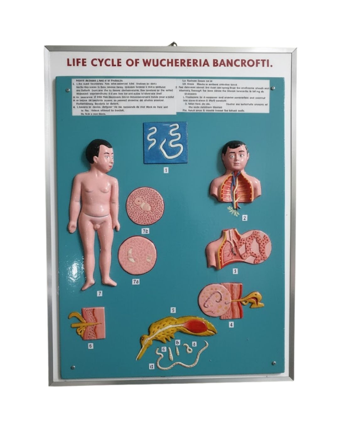 Life Cycle of Wuchereria bancrofti