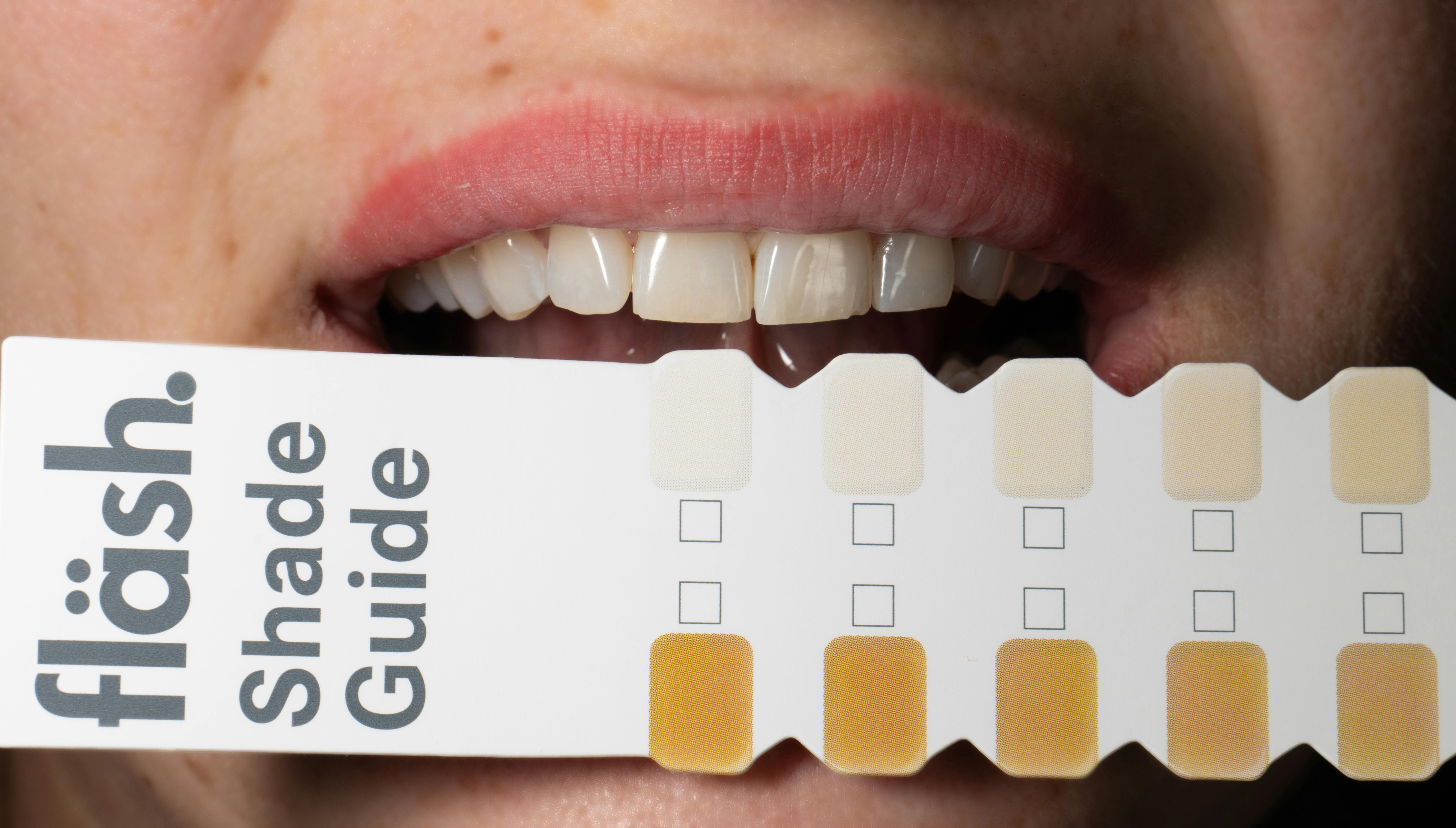 A picture of Dental shade guide comparing tooth whiteness levels against patient's smile