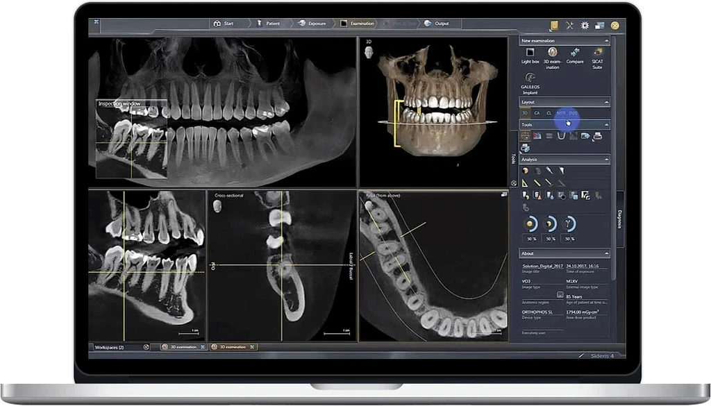 3D dental imaging