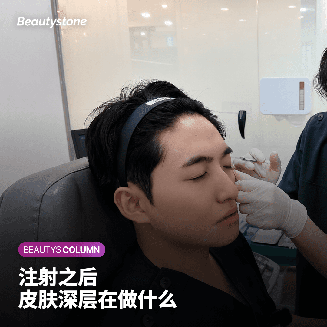 医生在诊室讲解胶原刺激剂进入皮肤深层之后的反应过程
