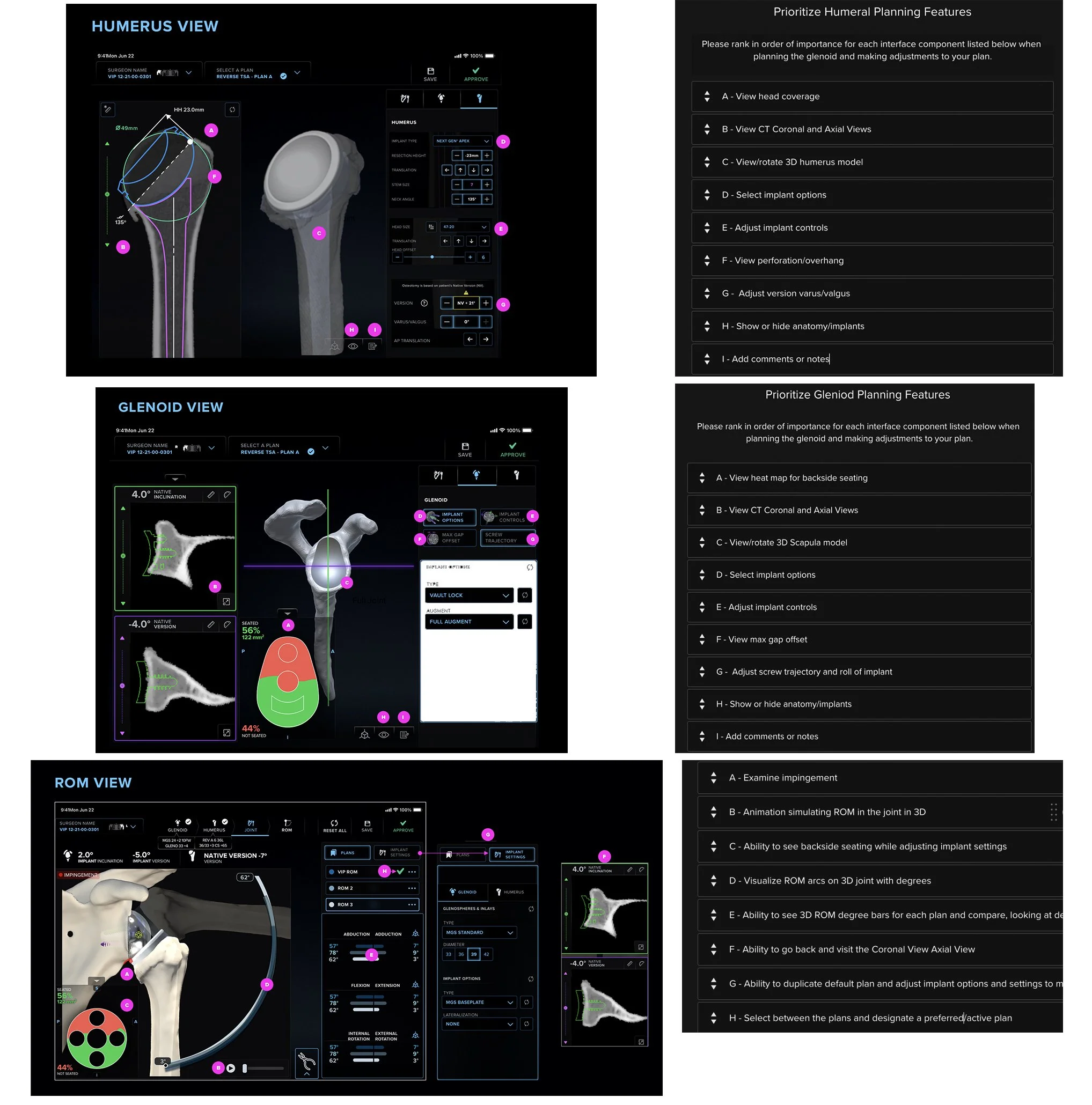 The VIP planning interface across surfaces, web/iPad, embedded hardware display, and the mobile screw-trajectory companion, showing the shared color and badge system